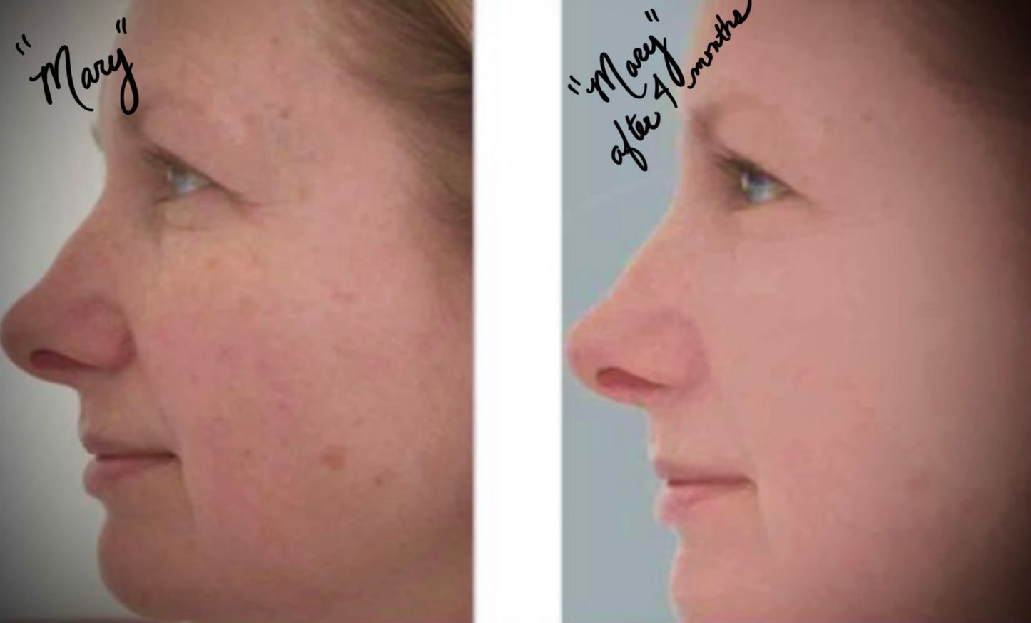 Miracle Serum